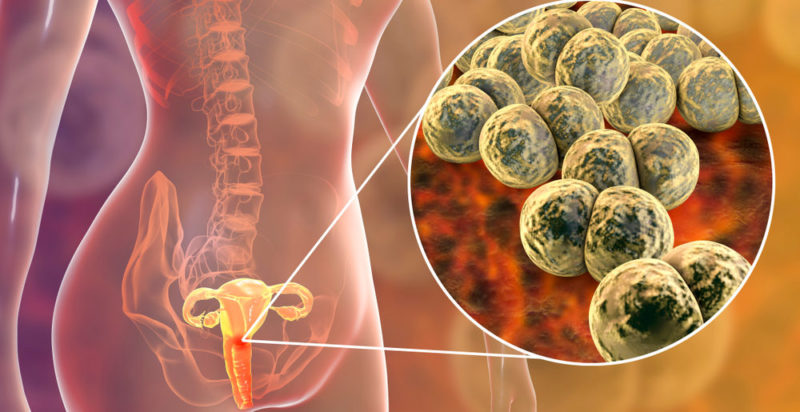 Gonorrea: Concepto, Síntomas y Tratamiento