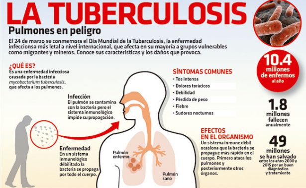 ¿qué Es Tuberculosis Concepto Definición Y Características