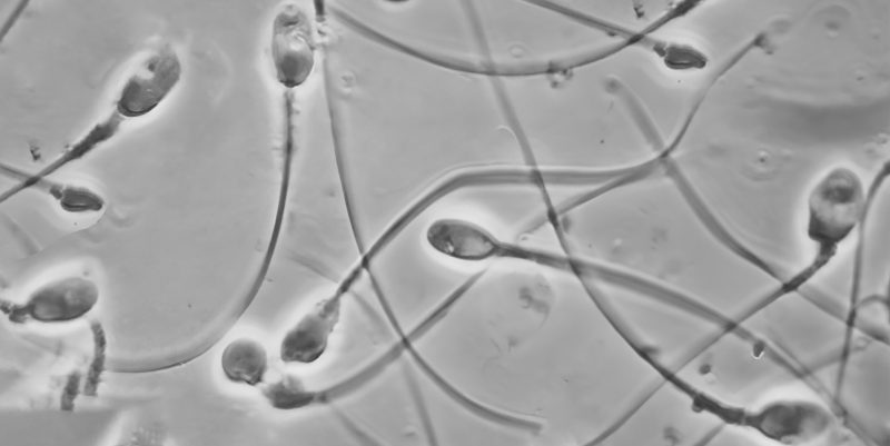 Micrografías electrónicas de células de esperma humano.