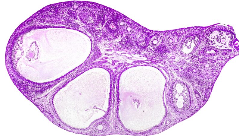 Micrografía óptica del ovario.