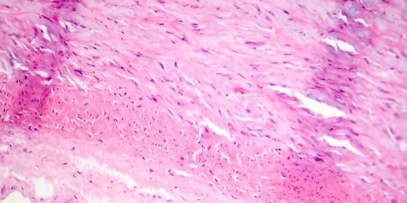 apoptosis celular necrosis tejido