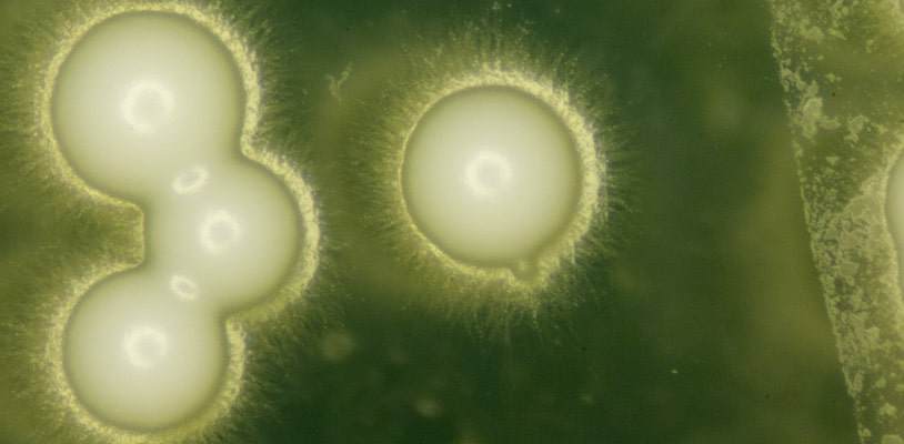 En la imagen tomada con un microscopio puede verse a las células dividiéndose.