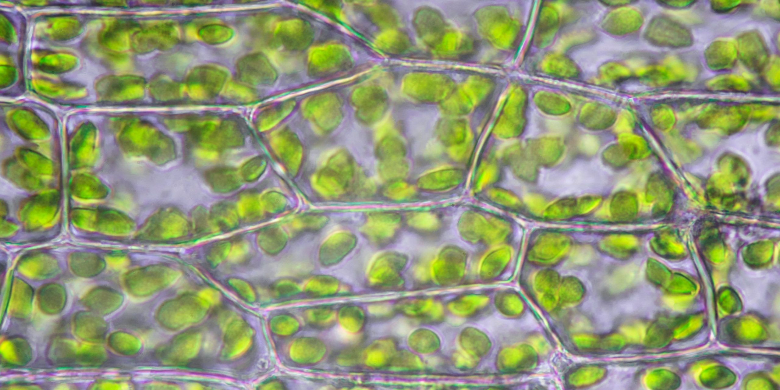 Cloroplastos en la hoja de una planta, vistos en el microscopio.